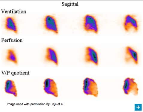 heart failure scan image heart failure scan image